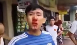 Công an Ninh Bình đang làm rõ clip 'tố' CSCĐ đánh người