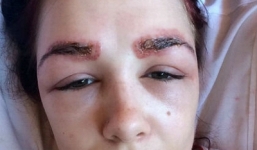 Cô gái suýt bị hỏng mắt vì nhuộm lông mày