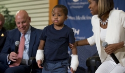 Phẫu thuật ghép đôi tay thành công cho cậu bé 8 tuổi