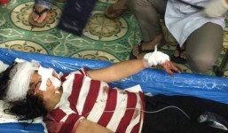 Phẫn nộ chồng bạo hành man rợ vợ rồi bỏ trốn