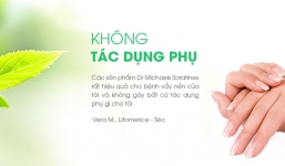 Điều trị bệnh vẩy nến hiệu quả cao, không tác dụng phụ