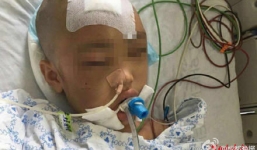 Bé gái 7 tuổi bị mẹ đánh chấn thương sọ não vì trộm tiền