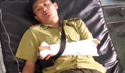 Một cán bộ kiểm lâm bị “lâm tặc” đánh gãy tay