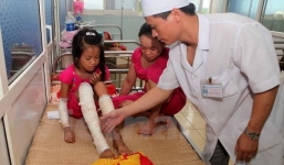 75 người bị bỏng phải nhập viện cấp cứu do đốt lửa trại