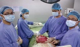 Phẫu thuật thành công khối u khổng lồ nặng 6,5 kg ở bụng dưới