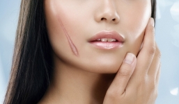 [Video khoa học] Sẹo hình thành như thế nào?