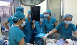 Video: Ca phẫu thuật cứu bé sơ sinh bị dao đâm vào đầu