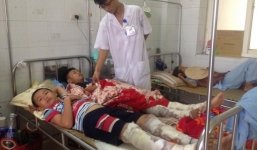 Học sinh bị bỏng nặng do đốt lửa trại sẽ được dạy bù