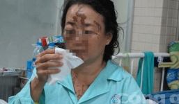 Cuồng ghen, tạt axit người trong mộng trước ngày cưới