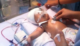 Bộ trưởng Bộ Y tế gửi thư khen ngợi y bác sĩ cứu bé sơ sinh bị đâm vào đầu