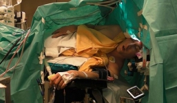 Video: Bệnh nhân vừa mổ não vừa hát opera