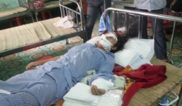 Chồng cắt gân chân, gân tay của vợ đối diện bản án nào?