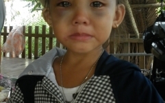 Nghi án bé gái 5 tuổi bị bà ngoại kế bạo hành