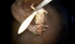 Video: Phát hiện con dế dài 8cm trong lỗ tai