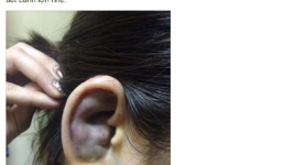 Thực hư bức ảnh cô gái ăn tiết canh bị nhiễm 'bệnh lạ'