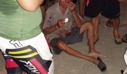 Đánh cụ ông nhập viện vì va chạm giao thông