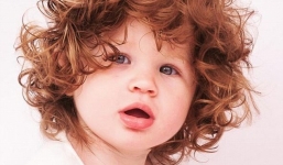 Bé gái xinh như thiên thần do mắc chứng bệnh hiếm gặp