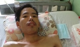 Bệnh nhân lao phổi bị hoại tử 1,2m ruột non được cứu sống