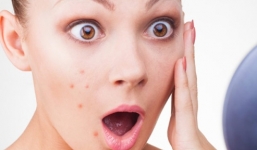 Bí quyết giúp làn da khổ trở nên mềm mại 