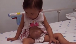 Phẫu thuật thành công cho bé gái có trái tim ngoài lồng ngực