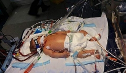 Trẻ sơ sinh tử vong tại bệnh viện, gia đình tố bác sĩ tắc trách