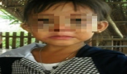 Bà ngoại kế bạo hành khiến bé gái 5 tuổi phải nhập viện cấp cứu