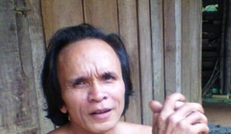 “Dị nhân” ở Quảng Bình không dám lấy vợ