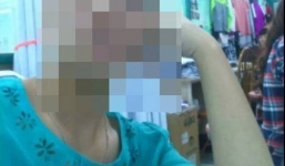 Bệnh  'không cười không khóc' lạ lùng hành hạ cuộc đời cô gái trẻ