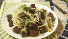 Ăn tiết xào giá đỗ, bệnh nhân nhập viện vì nhiễm liên cầu khuẩn lợn