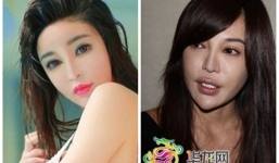 Nữ hoàng sắc đẹp Đài Loan trở thành 'thảm họa' thẩm mỹ