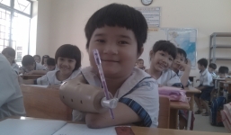 Cô bé 'chim cánh cụt': 'Con tự viết chữ bằng tay giả'