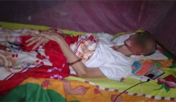 Bệnh lạ ăn mặt người đàn ông Tiền Giang là do vi khuẩn 'ăn thịt người'?