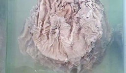 Người nhặt rác đào được cây nấm linh chi giá gần 1 tỷ USD