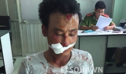 Thanh niên “ngáo đá” hành hung hai người đi đường trọng thương