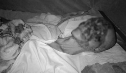 Người đàn ông bị bệnh lạ ăn gần hết khuôn mặt 