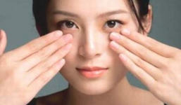 Quầng thâm, bọng mắt và cách chữa đơn giản hiệu quả