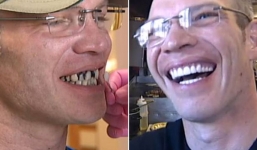 Chàng bồi bàn được boa nửa tỷ vì hàm răng quá xấu