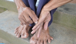 Người đàn ông có bàn chân kỳ lạ ở miền Tây