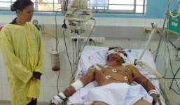 Nhiễm liên cầu khuẩn lợn do ăn tiết xào giá đỗ, bệnh nhân đã tử vong