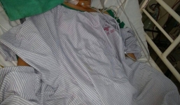 Phát hiện 40 con giun trong ống mật chủ của bệnh nhân nữ