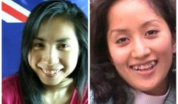 Ngỡ ngàng hàm răng thật xấu xí của mỹ nhân Việt