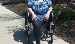 Bị cưa một chân do bị muỗi đốt dẫn đến cân mạc hoại tử