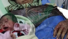 Video: Bé gái Syria chào đời với mảnh đạn găm trên đầu