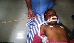 Bé trai sống sót thần kỳ sau khi bị mũi tên xuyên đầu