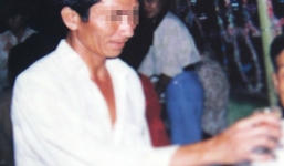 Thông tin mới về người đàn ông bị ăn mòn khuôn mặt ở Tiền Giang