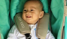 Bé trai văng khỏi bụng mẹ ở miền Tây được lắp chân giả