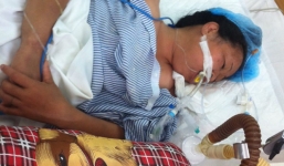Bị rắn cắn khi đang ngủ trưa, một phụ nữ nguy kịch