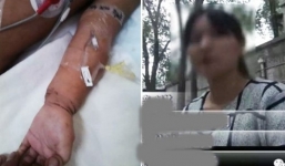 Bé gái 2 tuổi bị người tình của mẹ đánh thập tử nhất sinh