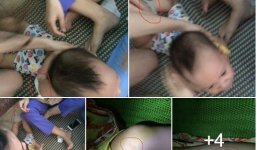 Bé trai 14 tháng bị 3 cô giáo bạo hành: 'Mẹ đau đớn đến quặn thắt'