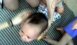 Bé 14 tháng bị bạo hành ở Quảng Bình: Bảo mẫu khai bị 'ép' nhận tội?